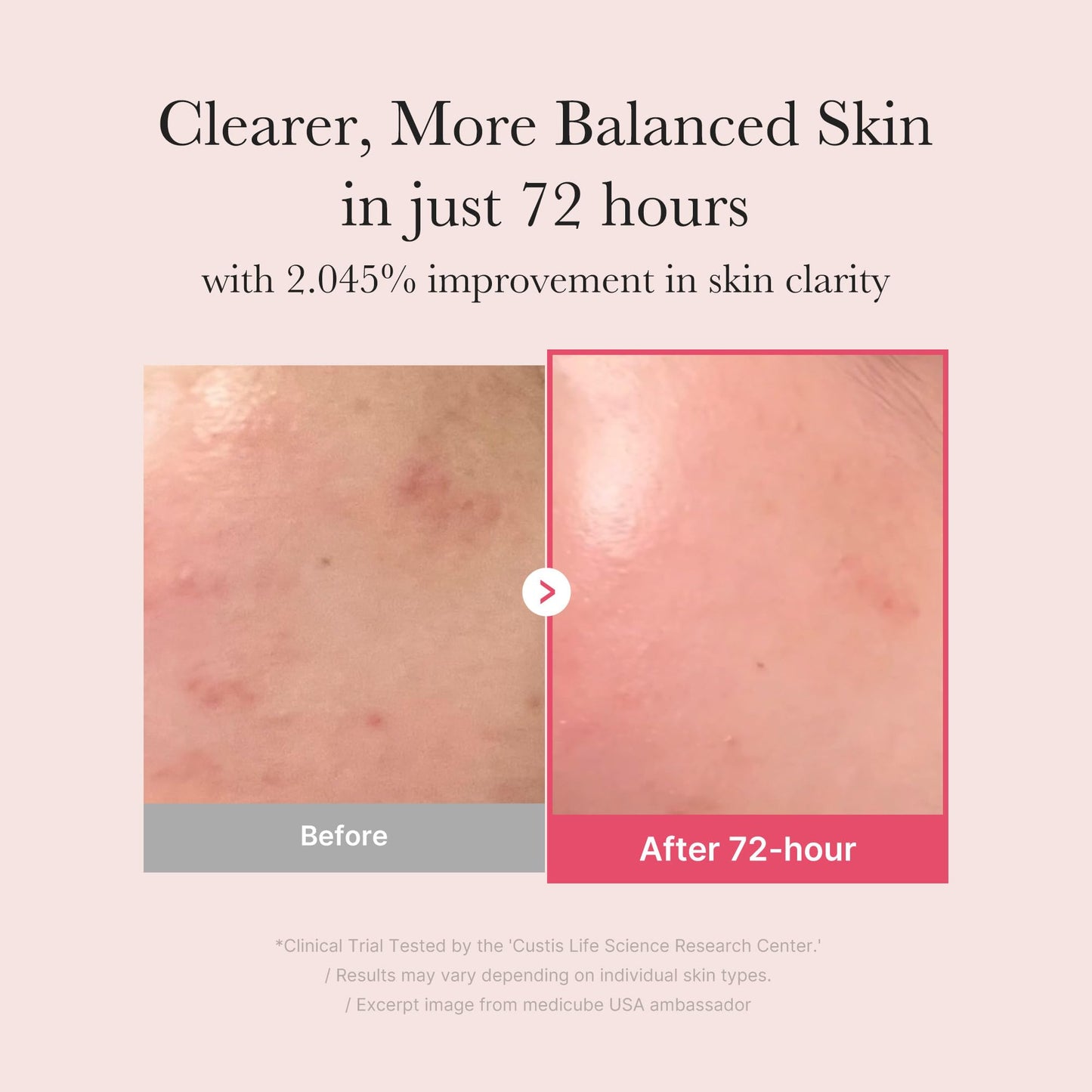 medicube TXA+Niacinamide 15% Glow Facial Serum for After Spot Care | All-in-One Daily Korean Skincare | Uneven Skin Tone, Texture, and Hydration Care | High-Potency Tranexamic Acid 5% | 1.01 fl.oz