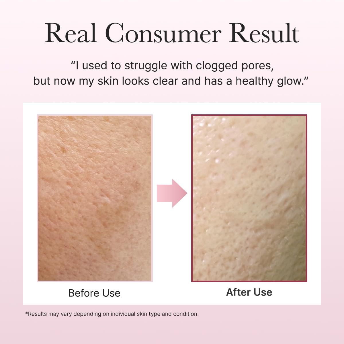 ARENCIA Korean Rice Mochi Face Cleanser - Face Wash, Gentle Scrub All in One for Deep Cleansing, Moisturizing, Pore Minimizing, Acne-Prone Skin, Removing Blackhead with Rice Water & Green Tea